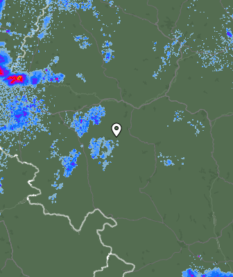 Radar