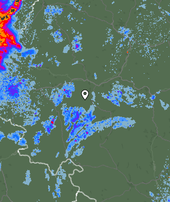 Radar
