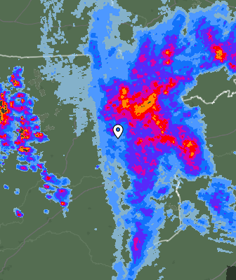 Radar