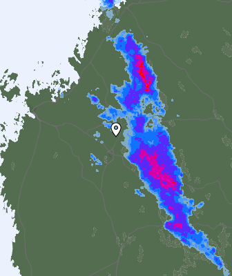 Radar