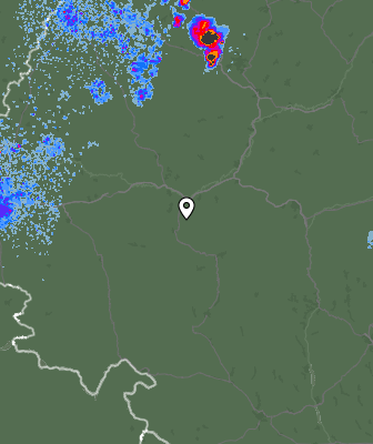 Radar