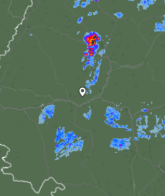 Radar