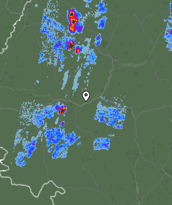 Radar