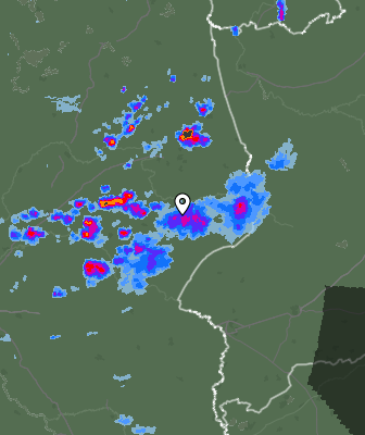 Radar