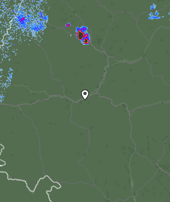 Radar
