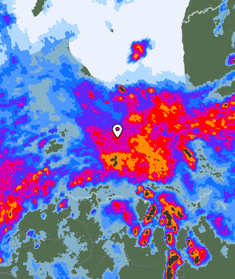 Radar