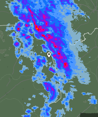 Radar