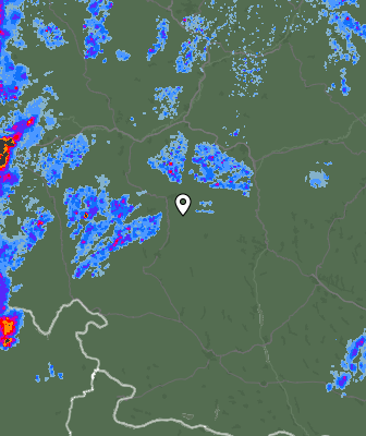 Radar
