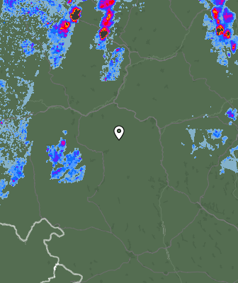 Radar