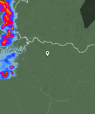 Radar