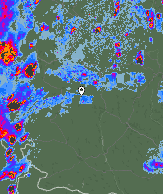 Radar
