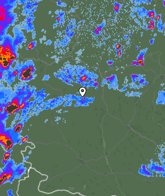 Radar