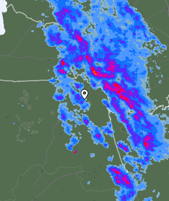 Radar