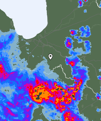 Radar