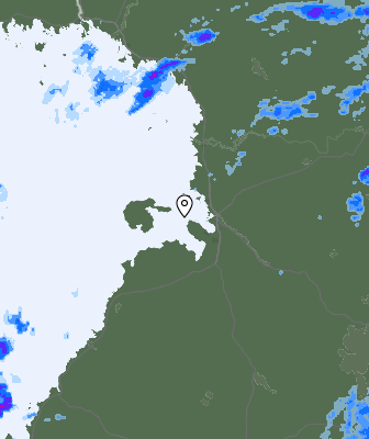 Radar