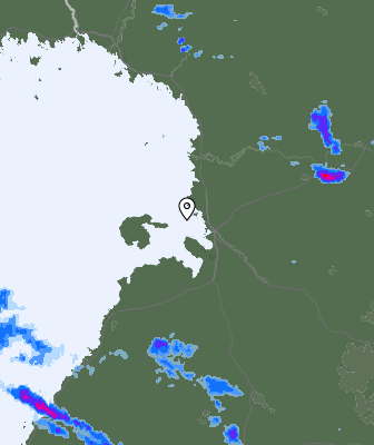 Radar