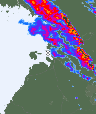 Radar