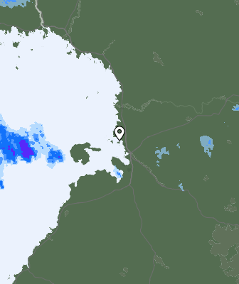 Radar