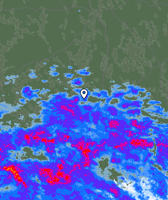 Radar
