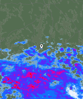 Radar