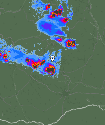 Radar