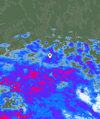 Radar