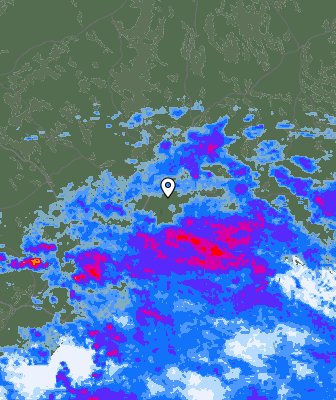 Radar