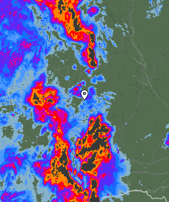 Radar