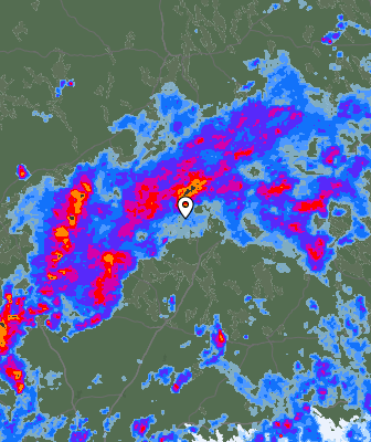 Radar