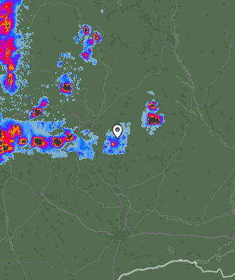 Radar