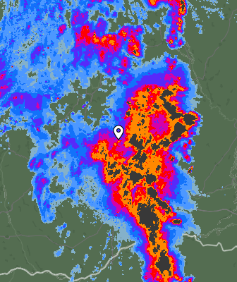 Radar
