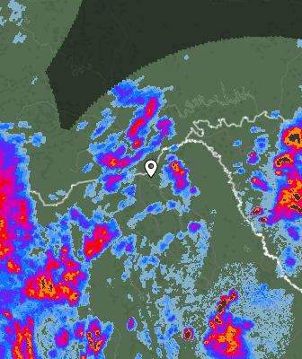 Radar