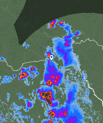 Radar