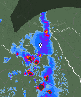 Radar