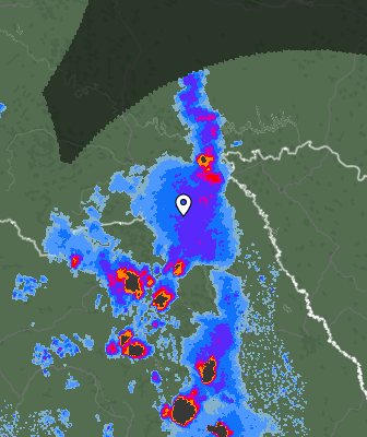Radar
