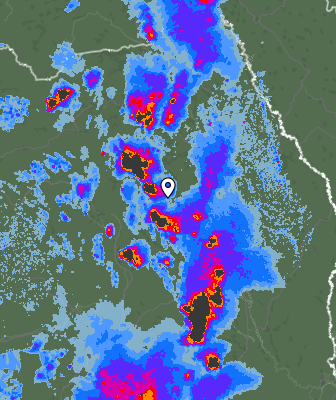Radar