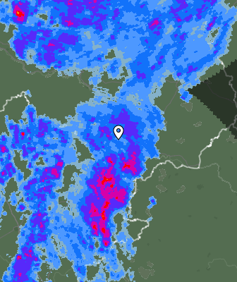 Radar
