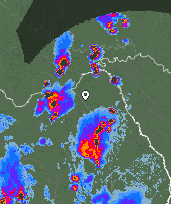 Radar