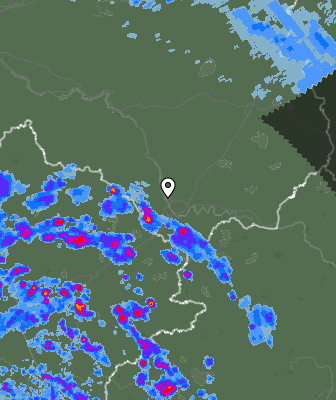 Radar