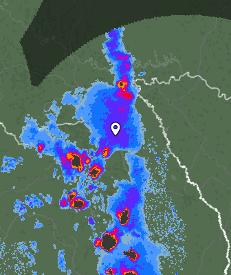 Radar