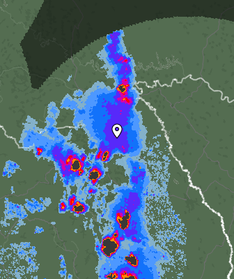 Radar