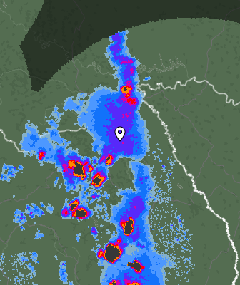 Radar