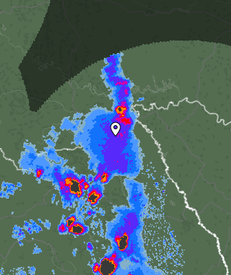 Radar
