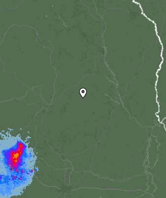 Radar