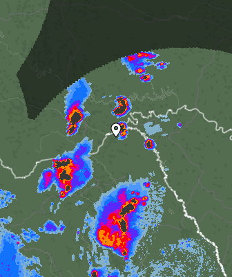 Radar