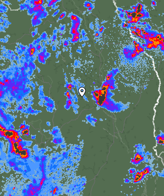 Radar