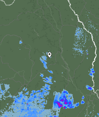Radar