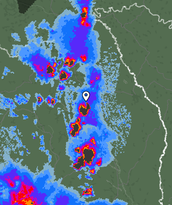 Radar