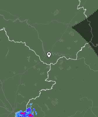 Radar