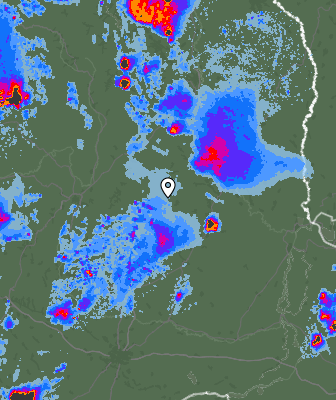 Radar